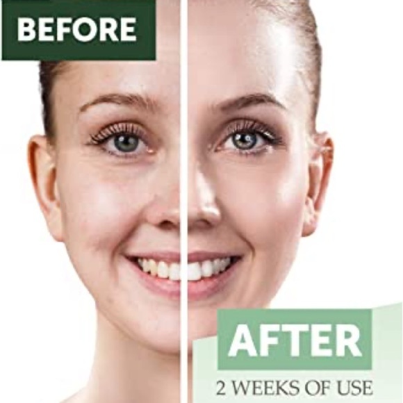 NEW Measurable Difference Jojoba Oil - Picture 6 of 8